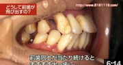 かみあわせ治療なら香川県 高松市 咬み合わせ専門歯科 吉本歯科医院