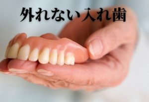 総入れ歯に替わる治療法｜香川県 高松市 入れ歯 吉本歯科医院