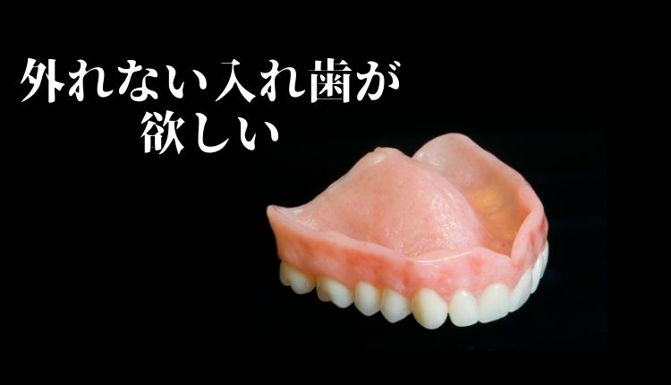 磁石式の入れ歯｜香川県 高松市 吉本歯科医院
