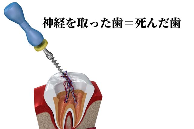 歯科の保険治療と保険外治療（自由診療）の違い｜香川県 高松市 吉本歯科医院