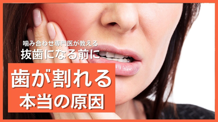 歯が割れる本当の原因｜抜歯になる前に｜高松市の吉本歯科医院AC
