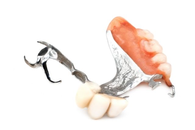 入れ歯で歯を失う事があることを知っていますか？｜高松市の咬み合わせ専門吉本歯科医院
